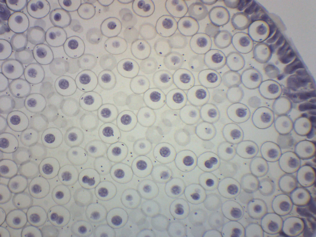Preparaciones Histológicas de Mitosis- Áscaris y Cebolla - Imagen 4