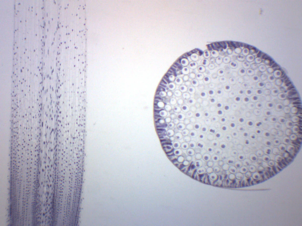 Preparaciones Histológicas de Mitosis- Áscaris y Cebolla - Imagen 2