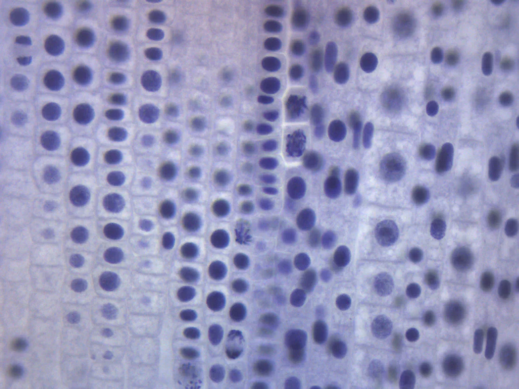 Preparaciones Histológicas de Mitosis- Áscaris y Cebolla - Imagen 6