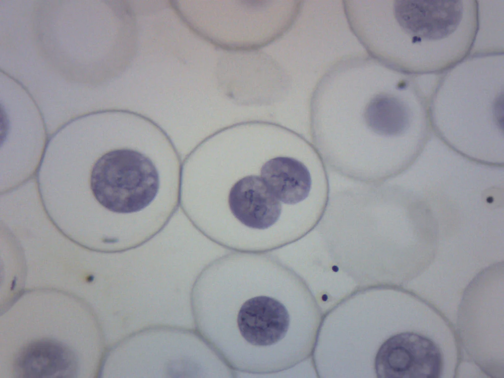 Preparaciones Histológicas de Mitosis- Áscaris y Cebolla - Imagen 5